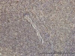 G protein alpha inhibitor 1 Antibody (2B8-2A5), Novus Biologicals 0.1 mg | Buy Online | Novus Biologicals | Fisher Scientific