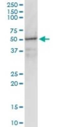 G protein alpha inhibitor 1 Antibody (2B8-2A5), Novus Biologicals 0.1 mg | Buy Online | Novus Biologicals | Fisher Scientific
