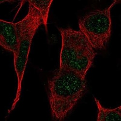 G-substrate Antibody, Novus Biologicals 25ul; Unconjugated:Antibodies,