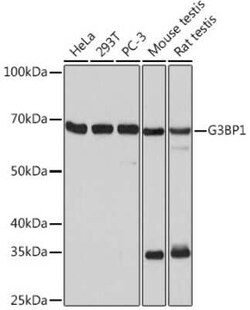 G3BP1 Rabbit anti-Human, Mouse, Rat, Clone: 5A4T0, Novus Biologicals 100 &mu;g | Buy Online | Novus Biologicals | Fisher Scientific