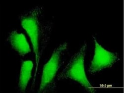 G3BP1 Antibody, Novus Biologicals 0.05 mg, Unconjugated:Antibodies, Polyclonal