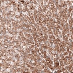 G6PC Antibody (CL5817), Novus Biologicals 25 &mu;L:Antibodies, Monoclonal