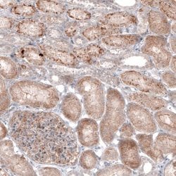 G6PC Antibody (CL5817), Novus Biologicals 25 &mu;L:Antibodies, Monoclonal