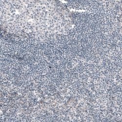 G6PC Antibody (CL5817), Novus Biologicals 25 &mu;L:Antibodies, Monoclonal