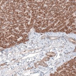 G6PC Antibody (CL5818), Novus Biologicals 25 &mu;L:Antibodies, Monoclonal