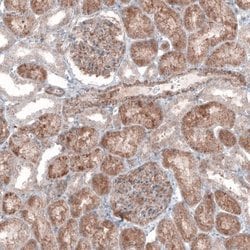 G6PC Antibody (CL5818), Novus Biologicals 25 &mu;L:Antibodies, Monoclonal