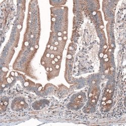 G6PC Antibody (CL5818), Novus Biologicals 25 &mu;L:Antibodies, Monoclonal