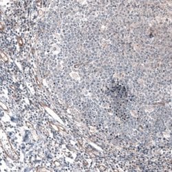 G6PC Antibody (CL5818), Novus Biologicals 25 &mu;L:Antibodies, Monoclonal