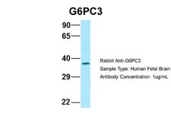 G6PC3 Rabbit anti-Human, Polyclonal, Novus Biologicals 0.1 mL | Buy Online | Novus Biologicals | Fisher Scientific