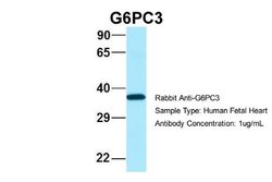 G6PC3 Rabbit anti-Human, Polyclonal, Novus Biologicals 0.1 mL | Buy Online | Novus Biologicals | Fisher Scientific