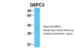 G6PC3 Rabbit anti-Human, Polyclonal, Novus Biologicals 0.1 mL | Buy Online | Novus Biologicals | Fisher Scientific