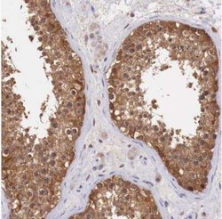 GAB2 Antibody, Novus Biologicals:Antibodies:Primary Antibodies