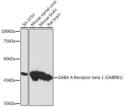 GABA-A R beta 1 Rabbit anti-Human, Mouse, Rat, Clone: 1Q3A9, Novus Biologicals 20 &mu;g | Buy Online | Novus Biologicals | Fisher Scientific