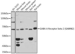 GABA-A R beta 2 Rabbit anti-Human, Mouse, Rat, Clone: 6G9O8, Novus Biologicals