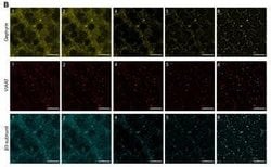GABA-A R beta 3 Antibody, Novus Biologicals 0.1mL; Unlabeled:Antibodies,