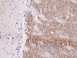 GABA-A R beta 3 Antibody, Novus Biologicals 0.1mL; Unlabeled:Antibodies,