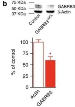 GABA-A R beta 3 Antibody, Novus Biologicals 0.1mL; Unlabeled:Antibodies,