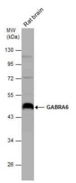 GABA-AR alpha 6 Antibody, Novus Biologicals 100 &mu;g | Buy Online | Novus Biologicals | Fisher Scientific