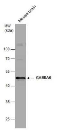 GABA-AR alpha 6 Antibody, Novus Biologicals 100 &mu;g | Buy Online | Novus Biologicals | Fisher Scientific