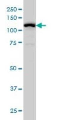 GABA-B R1 Antibody (2D7), Novus Biologicals 0.1 mg | Buy Online | Novus Biologicals | Fisher Scientific