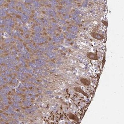 GABA-B R2 Antibody, Novus Biologicals:Antibodies:Primary Antibodies
