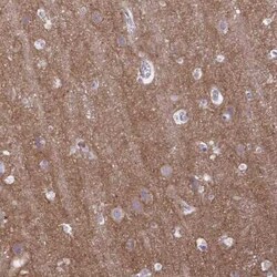 GABA-B R2 Antibody, Novus Biologicals:Antibodies:Primary Antibodies