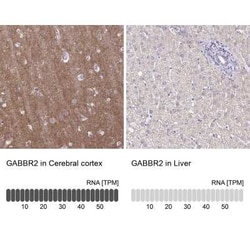 GABA-B R2 Antibody, Novus Biologicals:Antibodies:Primary Antibodies