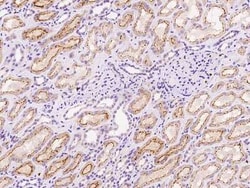 GABA Receptor Epsilon Antibody, Novus Biologicals 100 &mu;g, Unconjugated:Antibodies,