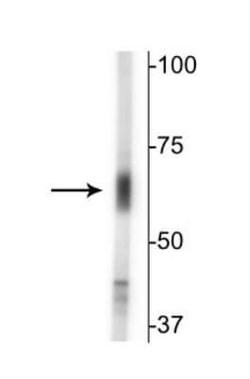 GABA Transporter 2 Antibody, Novus Biologicals 0.1mL; Unlabeled:Antibodies,