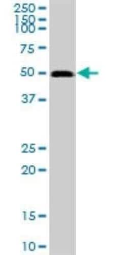 GABPB1 Antibody, Novus Biologicals 0.05 mg | Buy Online | Novus Biologicals | Fisher Scientific