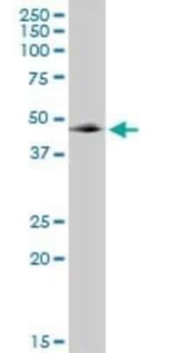 GABPB1 Antibody, Novus Biologicals 0.05 mg | Buy Online | Novus Biologicals | Fisher Scientific