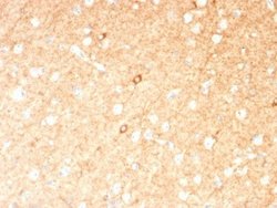 GAD1/GAD67 Antibody (GAD1/2391) - Azide and BSA Free, Novus Biologicals 100 &mu;g | Buy Online | Novus Biologicals | Fisher Scientific