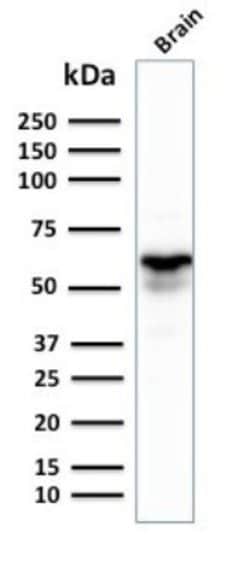 GAD1/GAD67 Antibody (GAD1/2391) - Azide and BSA Free, Novus Biologicals 100 &mu;g | Buy Online | Novus Biologicals | Fisher Scientific