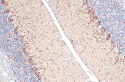 GAD1/GAD67 Antibody (HL1096), Novus Biologicals 100 &mu;g | Buy Online | Novus Biologicals | Fisher Scientific