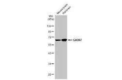 GAD1/GAD67 Antibody (HL1096), Novus Biologicals 100 &mu;g | Buy Online | Novus Biologicals | Fisher Scientific