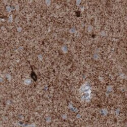 GAD1/GAD67 Antibody (CL2914), Novus Biologicals 25 &mu;L, Unconjugated:Antibodies,