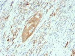 GAD2/GAD65 Antibody (GAD2/2362) - Azide and BSA Free, Novus Biologicals 100 &mu;g | Buy Online | Novus Biologicals | Fisher Scientific