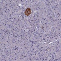 GAD2/GAD65 Antibody, Novus Biologicals 0.1 mL | Buy Online | Novus Biologicals | Fisher Scientific