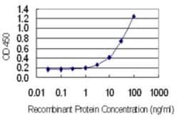 GAGE1 Antibody (4G6), Novus Biologicals 0.1 mg; Unconjugated:Antibodies,