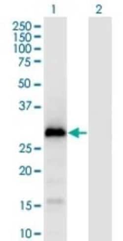 GAGE1 Antibody (4G6), Novus Biologicals 0.1 mg; Unconjugated:Antibodies,
