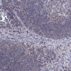 GAJ Antibody, Novus Biologicals 25ul; Unconjugated:Antibodies, Polyclonal