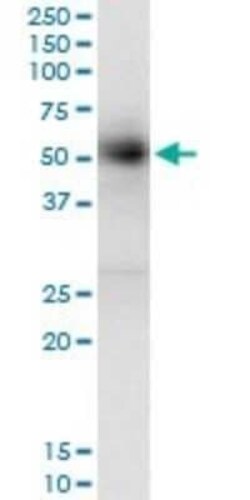 GAK Antibody (4C10), Novus Biologicals 0.1 mg | Buy Online | Novus Biologicals | Fisher Scientific