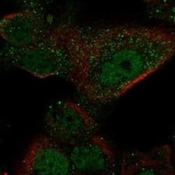 GAL3ST1 Rabbit anti-Human, Polyclonal, Novus Biologicals 25 &mu;g; Unconjugated:Antibodies,
