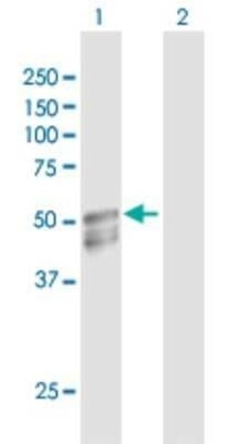 GAL3ST1 Antibody, Novus Biologicals 0.1 mg | Buy Online | Novus Biologicals | Fisher Scientific
