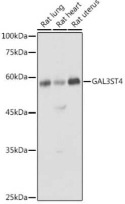 GAL3ST4 Rabbit anti-Human, Mouse, Rat, Polyclonal, Novus Biologicals 100