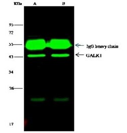 GALK1 Antibody, Novus Biologicals 100 &mu;g; Unconjugated:Antibodies, Polyclonal