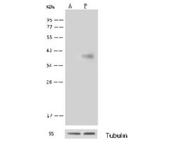 GALK1 Antibody, Novus Biologicals 100 &mu;g; Unconjugated:Antibodies, Polyclonal