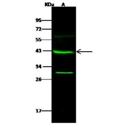 GALK1 Antibody, Novus Biologicals 100 &mu;g; Unconjugated:Antibodies, Polyclonal
