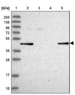GALK2 Antibody, Novus Biologicals 25 &mu;L, Unconjugated:Antibodies, Polyclonal