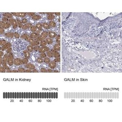 GALM Antibody, Novus Biologicals:Antibodies:Primary Antibodies